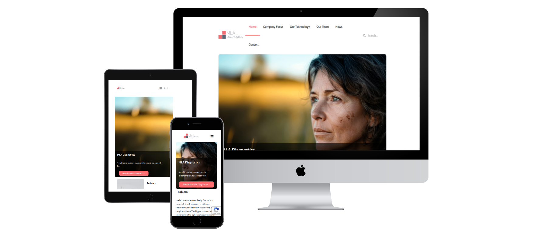 MLA Diagnostics - Succescase